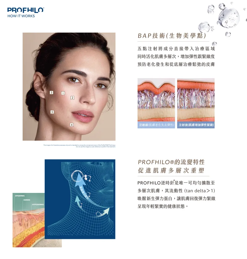 逆時針 產品圖 18